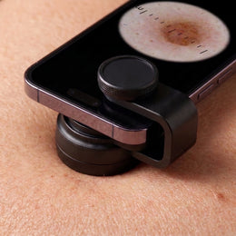 Derm&Root Skin Scope