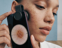 Derm&Root Skin Scope
