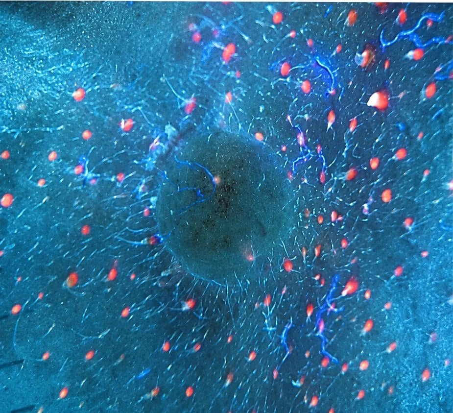 Close-up skin image under ultraviolet light